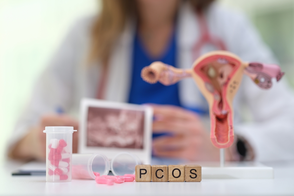 PCOS Treatment